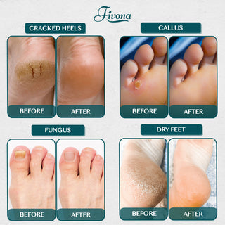 Foot Soak Blend with Tea Tree - 2Lb