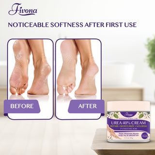 40% Urea Cream with Lavender