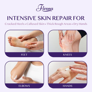 40% Urea Cream with Lavender