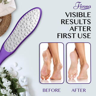 Fivona Foot File | Double Sided Hard Skin Remover