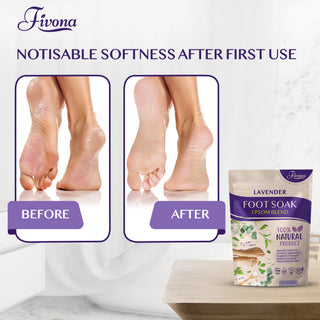 Fivona Foot Soak Blend Bittersalz mit Lavendel 14,1 oz – Beruhigendes Fußbadesalz, entspannt und erneuert müde Füße, lindert Schmerzen, mildert Schwielen 