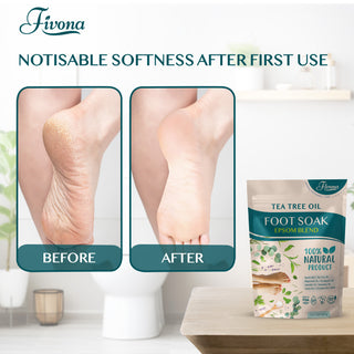 Fivona Tea Tree Foot Soak Blend 14.1 oz - Sal de Epsom con aceites esenciales para uñas de los pies saludables, alivio calmante, control de olores, suavizante de callos